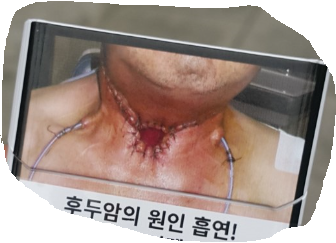 금연터와 흡연터 우리의 선택 (커뮤니티 - 자유게시판)