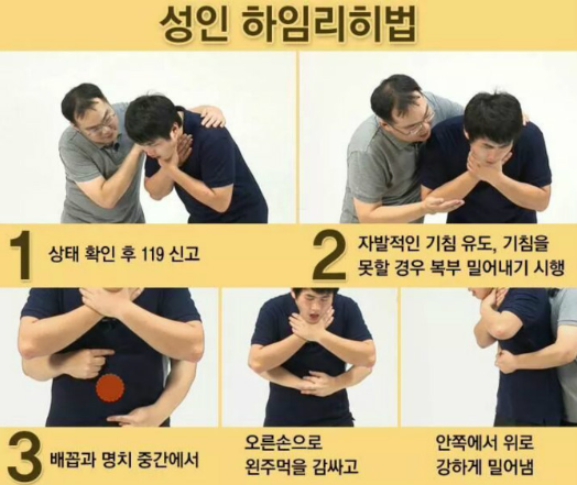 기도폐쇄 하임리히법 (커뮤니티 - 자유게시판)