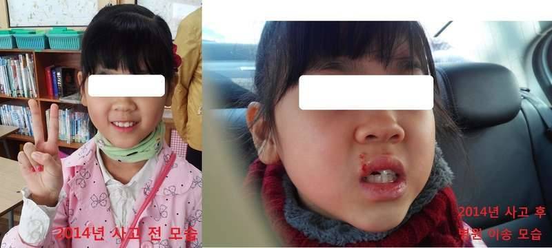 꼭 사진보시고도와 주세요 긴글 이지만 관심 부탁드려요붕어 리믹스 (커뮤니티 - 자유게시판)