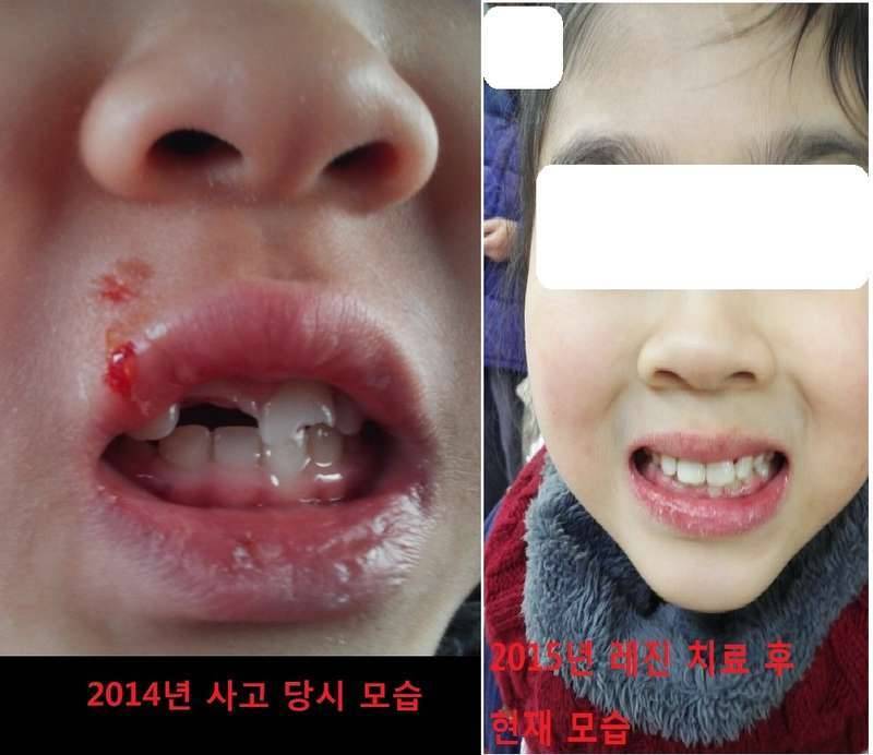꼭 사진보시고도와 주세요 긴글 이지만 관심 부탁드려요붕어 리믹스 (커뮤니티 - 자유게시판)