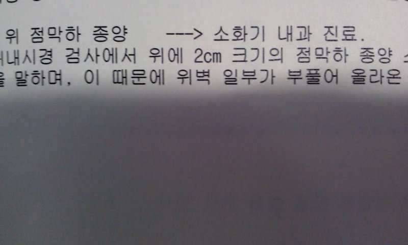 위점막하종양 (커뮤니티 - 자유게시판)