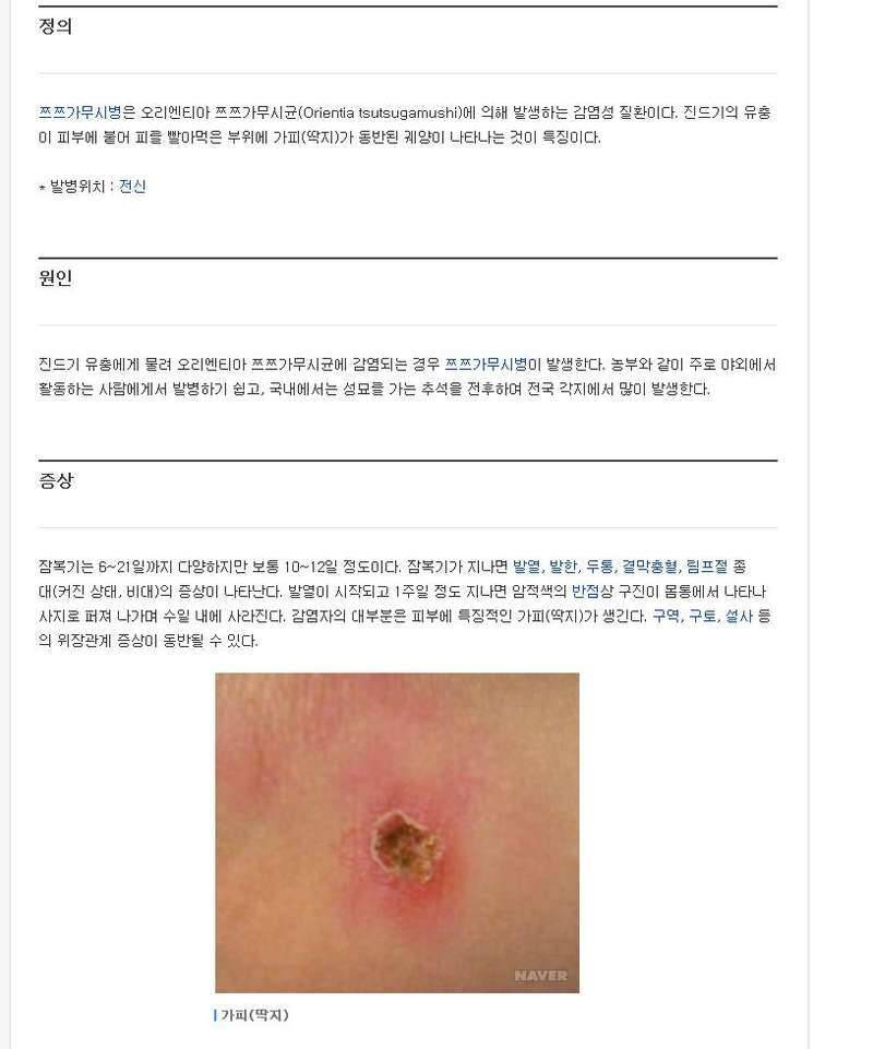 쯔쯔가무시 조심하세요 (커뮤니티 - 자유게시판)
