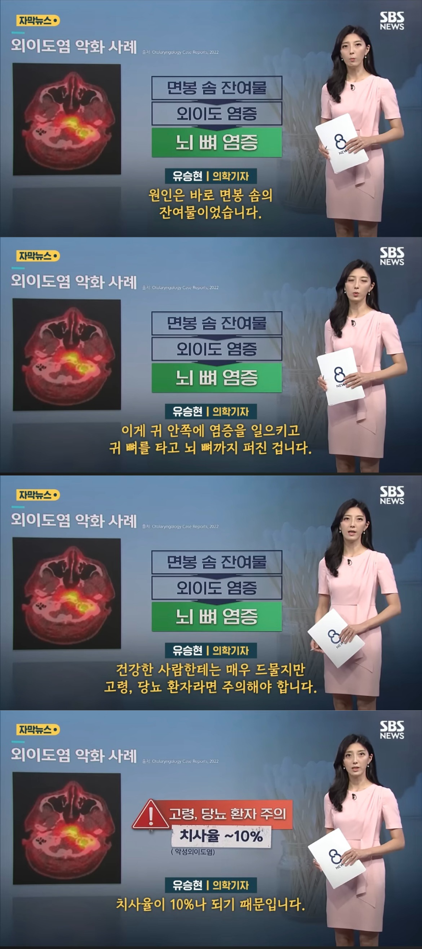 면봉을 안 쓰는 이유 (커뮤니티 - 자유게시판)