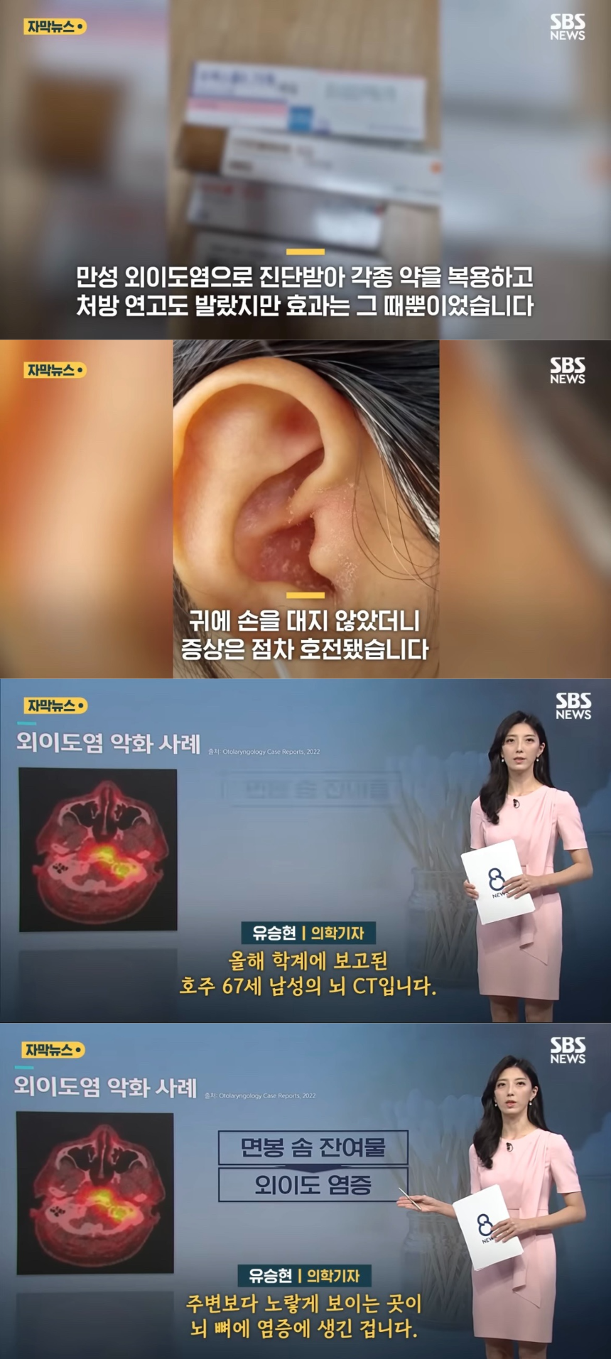 면봉을 안 쓰는 이유 (커뮤니티 - 자유게시판)