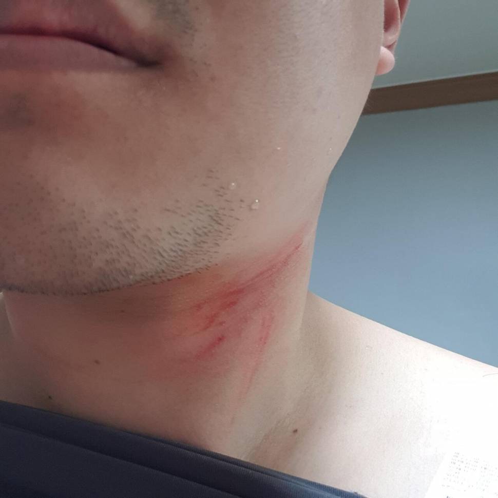 낚시하러갔다가 폭행 및 성폭력당했습니다 (커뮤니티 - 자유게시판)