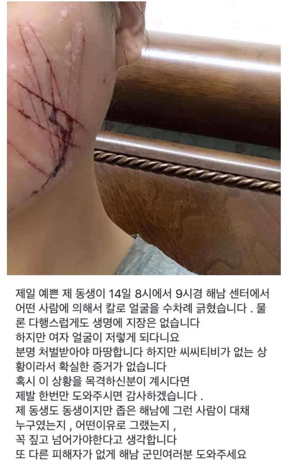 묻지마 테러 당한 여동생을 신고한 오빠 (커뮤니티 - 자유게시판)