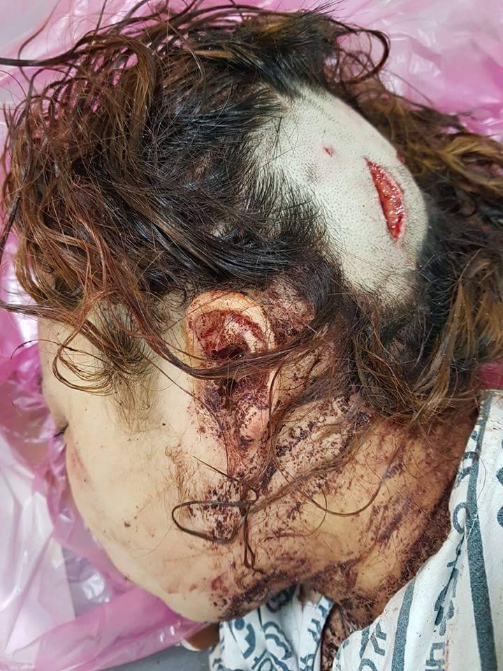 14세 미만 형사처벌에 대한 여러분에 생각혐사진첨부 (커뮤니티 - 이슈토론방)