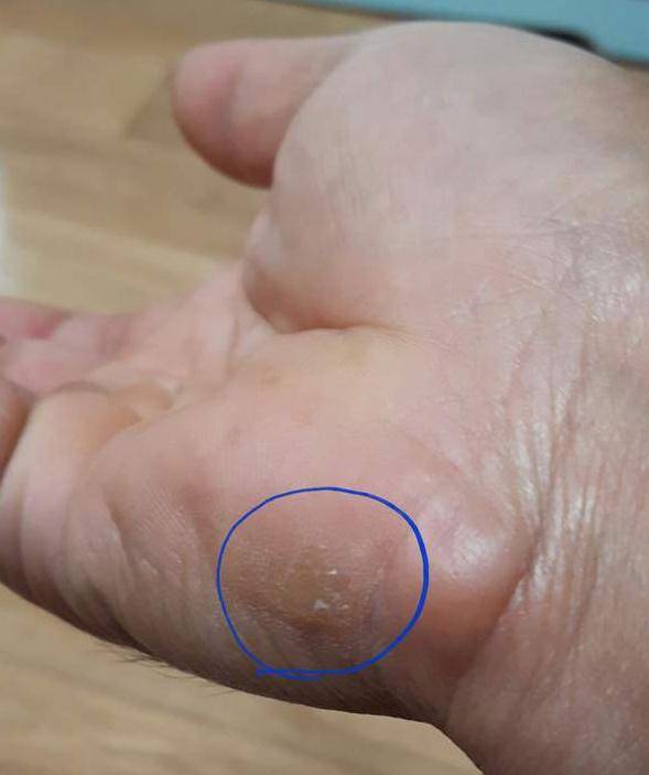 나는 정말 환자구나 라고 느낄때 (월척지식 - 기타지식)