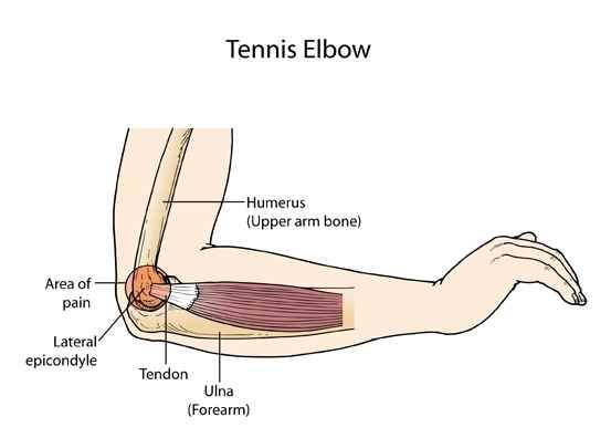 엘보elbow란 (월척지식 - 대물낚시)